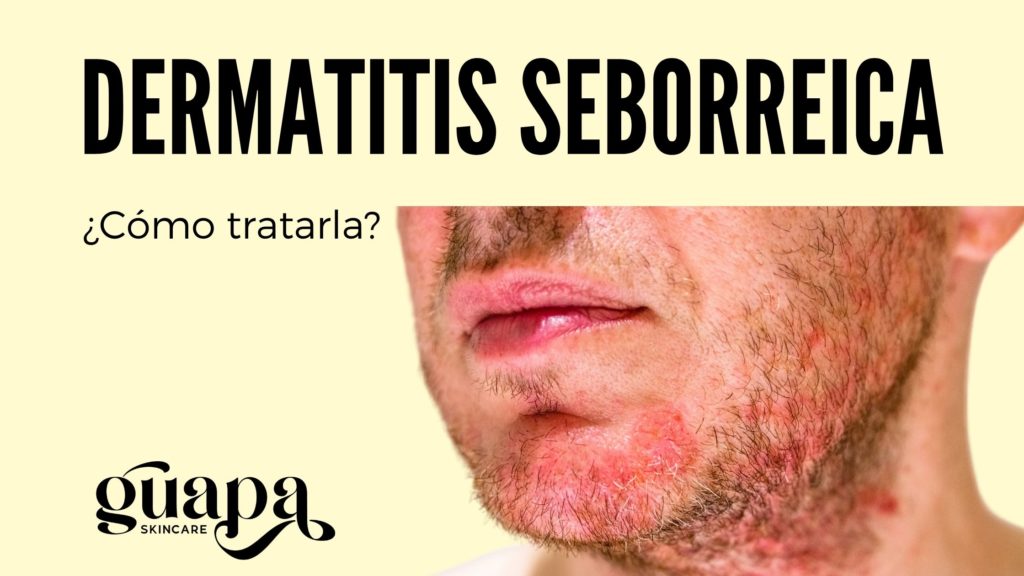 DERMATITIS SEBORREICA